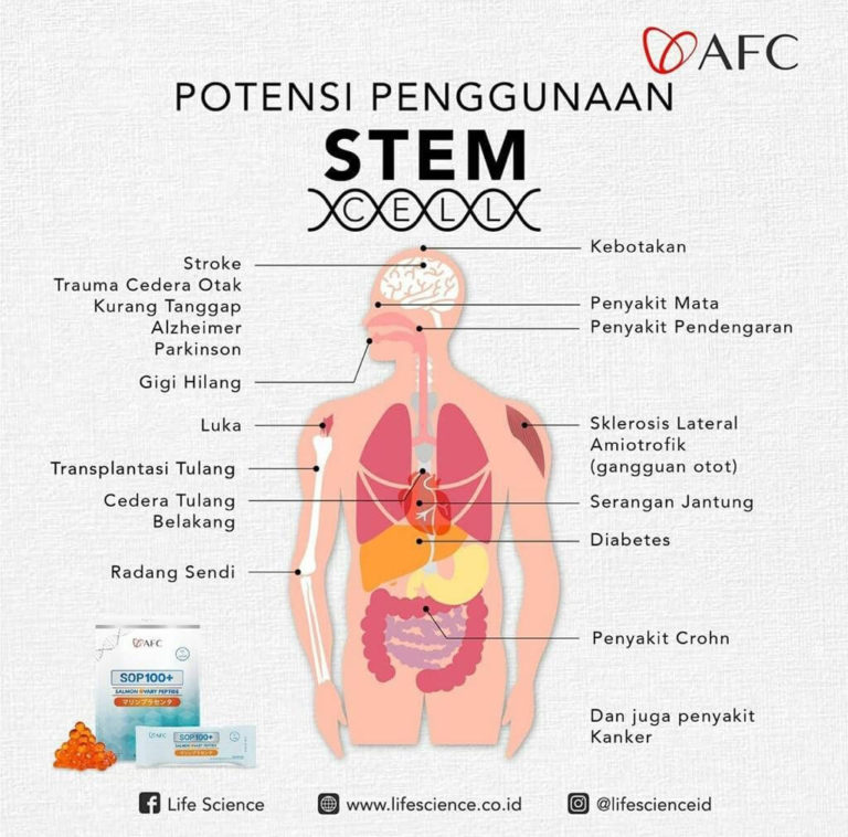 Stem Cell Therapy2