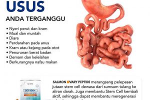 Usus