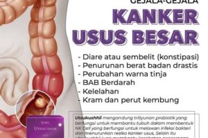 Kanker Usus Besar