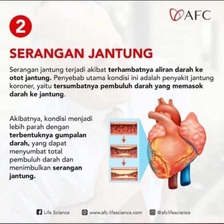 Serangan Jantung 2