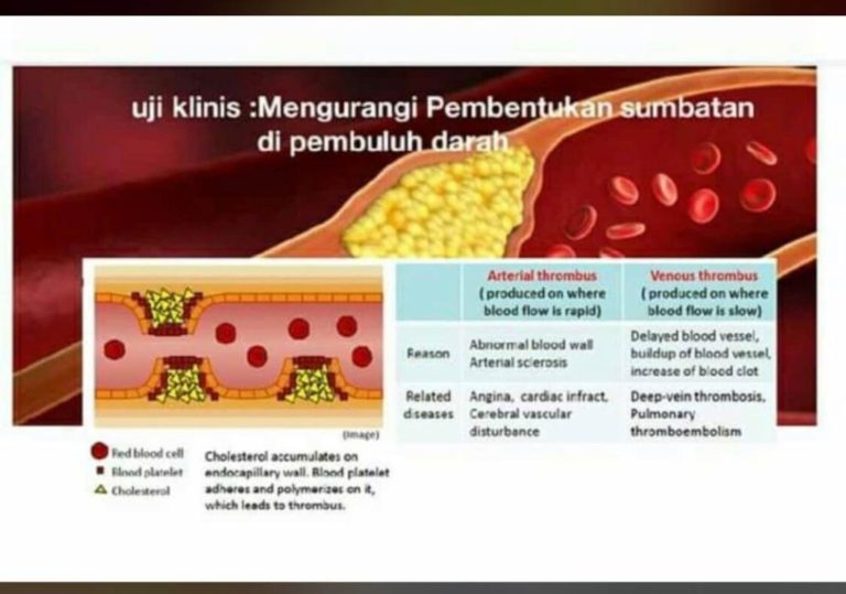 Serangan Jantung 4