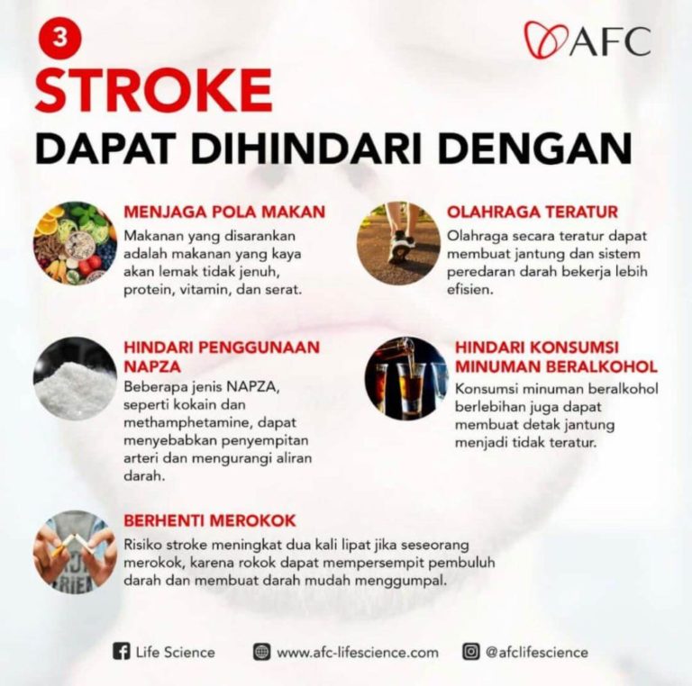 Stroke 3