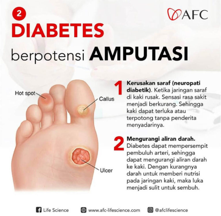 Diabetes 2