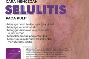 Selulitis