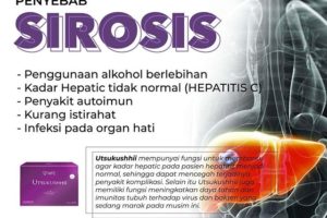 Sirosis