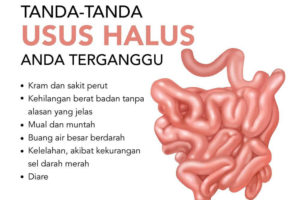 Usus Halus