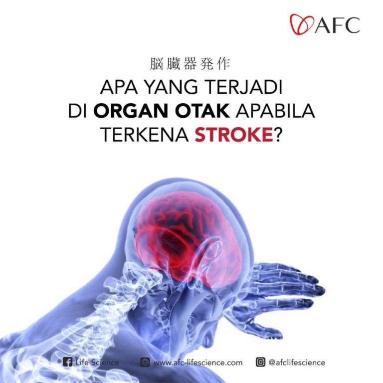 Stroke Pada Otak - 1