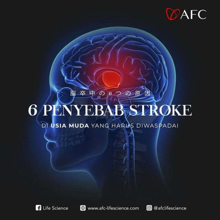 6 Penyebab Stroke0