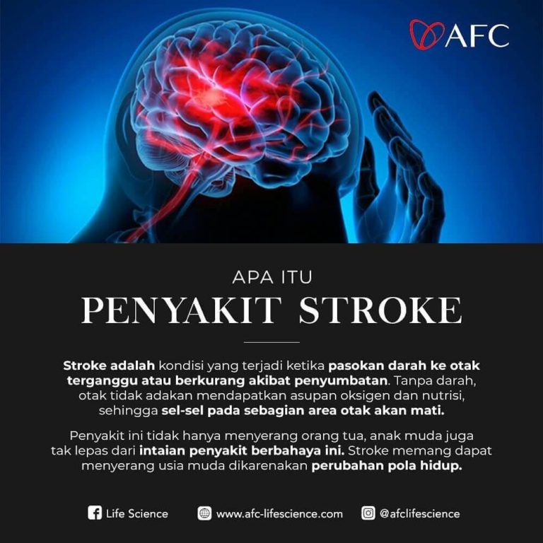 6 Penyebab Stroke0a