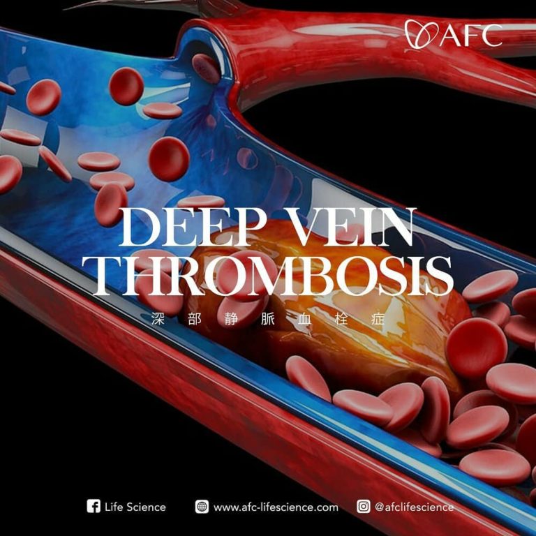 Deep Vein Thrombosis0