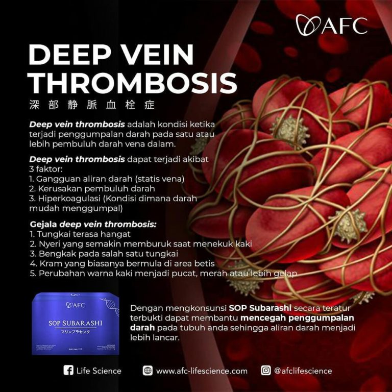 Deep Vein Thrombosis1