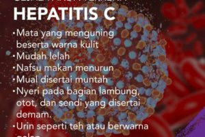 Gejala Hepatitis C