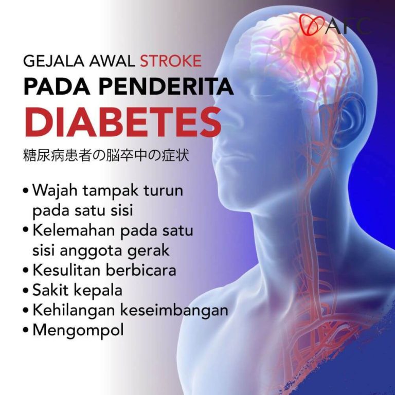 Gejala Stroke Pada Diabetes