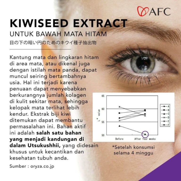 Kiwiseed - Bawah Mata Hitam